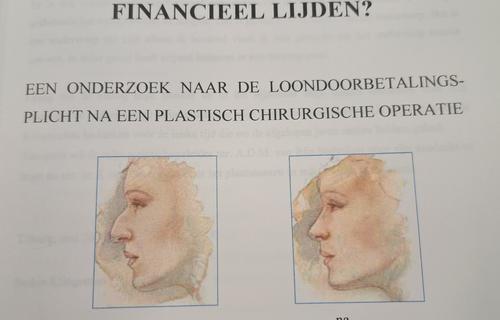 Wie mooi wil zijn, moet financieel lijden (deel 2: bovenwettelijk deel)